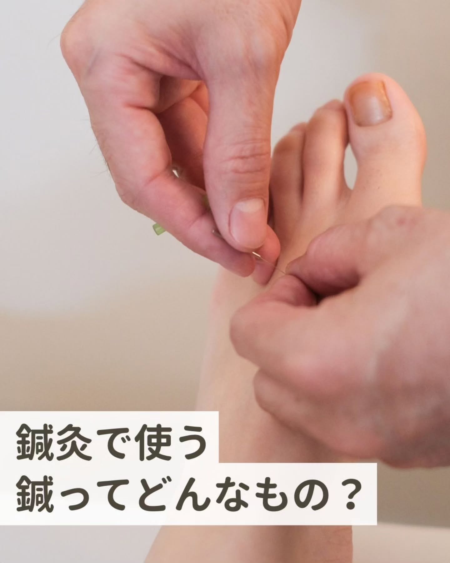 鍼灸で使う鍼ってどんなもの？